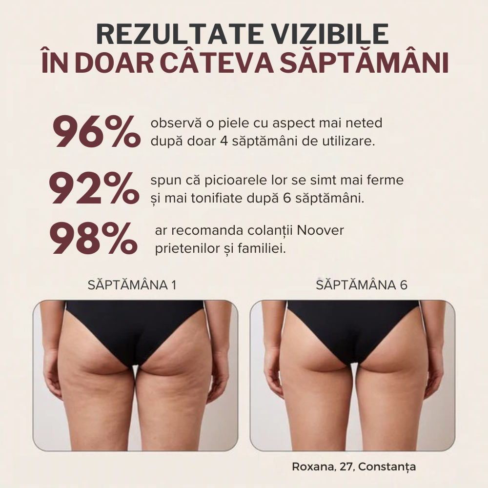 Colanți 3D cu compresie anticelulitic