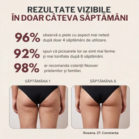 Colanți 3D cu compresie anticelulitic
